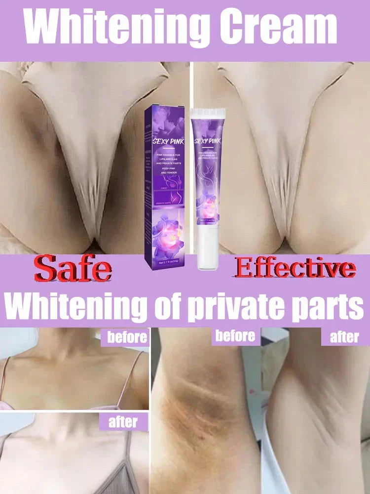 Skin Whitening Cream for Dark Skin Lightening Private Parts Whitening Cream  Arm Thigh Body Knees Whitening Brighten Skin Mild