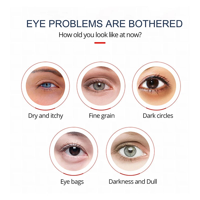 Retinol Eye Cream Remove Dark Circles Eye Bags Anti-Wrinkle Fade Fine Lines Anti-Puffiness Nourishing Professional Eye Care